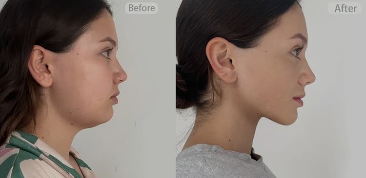 پرسشنامه 30 ثانیه‌ای که آینده سلامت و زیبایی شما را پیش‌بینی می‌کند