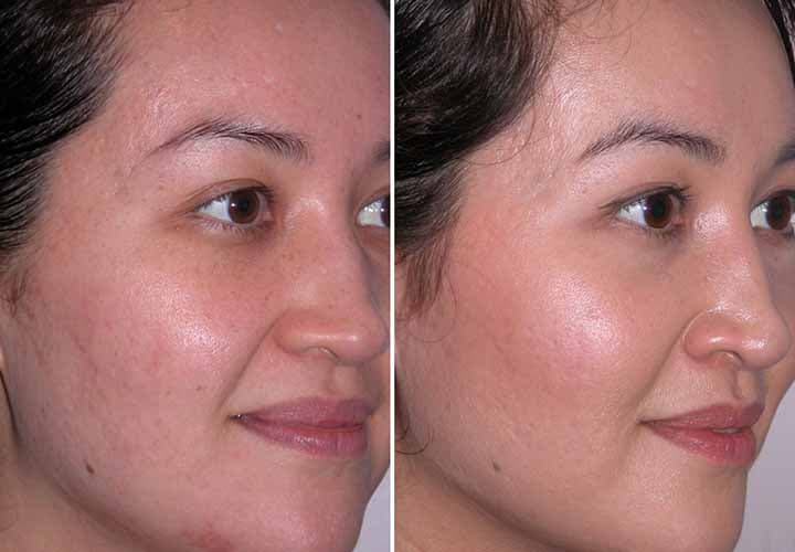 پرسشنامه 30 ثانیه‌ای که آینده سلامت و زیبایی شما را پیش‌بینی می‌کند